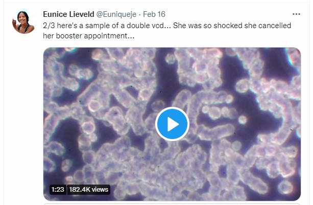 WATCH: Vaccinated Blood Crawling with Bacteria and Parasites in Live Blood Analysis, Numbers Never Seen Before Says Eunice Lieveld, Blood Researcher